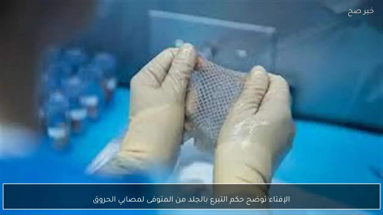 الإفتاء توضح حكم التبرع بالجلد من المتوفى لمصابي الحروق