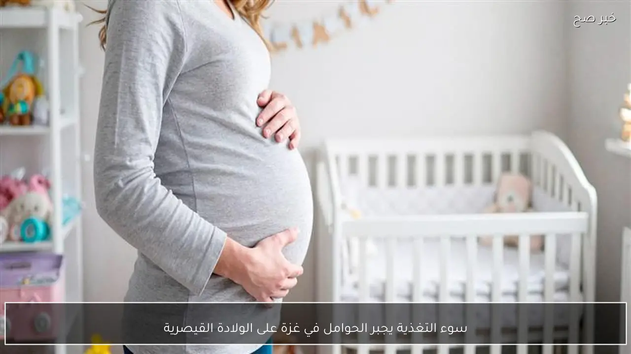 سوء التغذية يجبر الحوامل في غزة على الولادة القيصرية