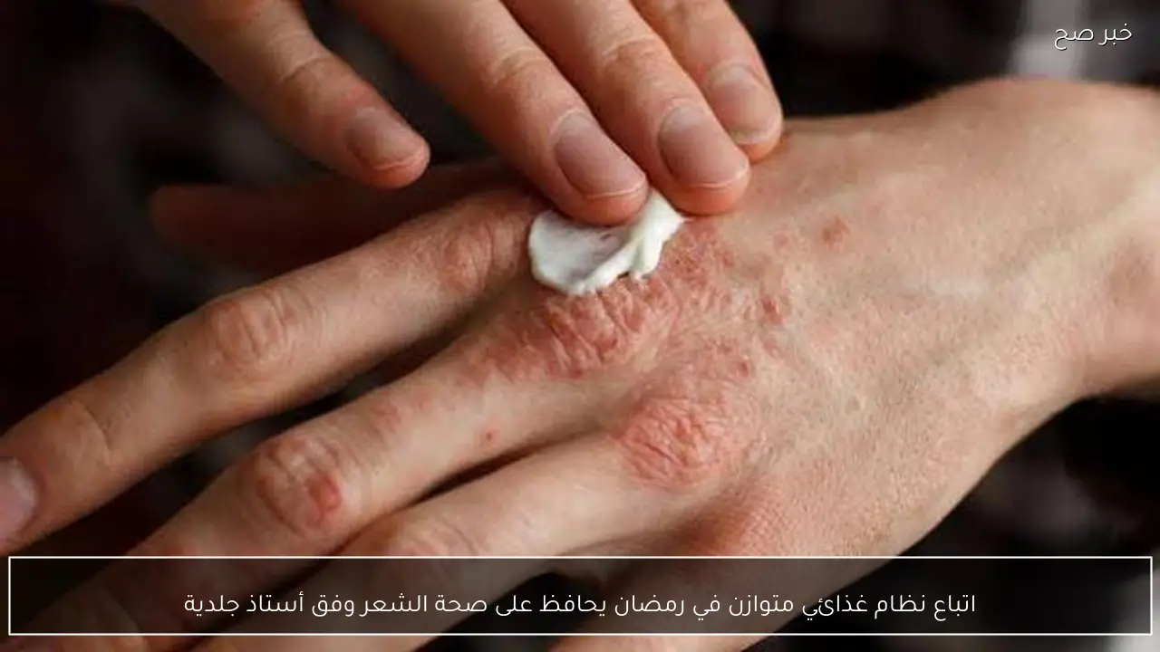 اتباع نظام غذائي متوازن في رمضان يحافظ على صحة الشعر وفق أستاذ جلدية