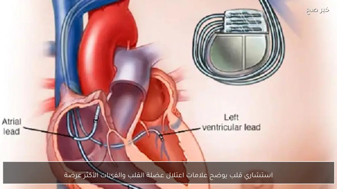 استشاري قلب يوضح علامات اعتلال عضلة القلب والفئات الأكثر عرضة
